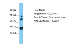GARNL1 Rabbit anti-Human, Polyclonal, Novus Biologicals 0.1ml; Unconjugated:Antibodies,